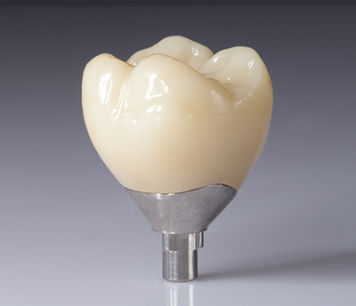 Digital CAD CAM Dental Lab Crowns Translucent Layered Zirconia Crown - buying leads